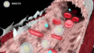 Development of atherosclerosis [upl. by Dorolice]