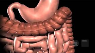 Gastric bypass in het Obesitascentrum Catharina Ziekenhuis [upl. by Ticon]