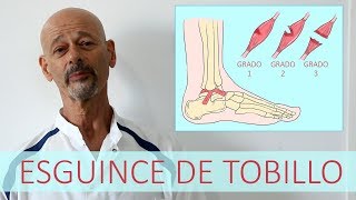 ESGUINCE DE TOBILLO  Lesión de ligamentos [upl. by Inva427]