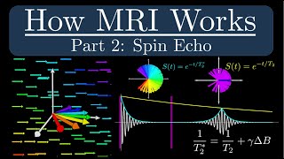 How MRI Works  Part 2  The Spin Echo [upl. by Spearman]