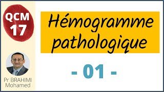 Hémogramme pathologique  Hématologie QCM 17 [upl. by Nahtnhoj]