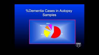 3 Dementia Lewy Bodies  Atypical Parkinsonism DLB PSP MSA CBSCBD Symposium [upl. by Egiaf431]