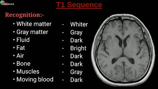 MRI Sequences  Radiology Buzz [upl. by Odanref]