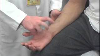 Tinels Test of the Ulnar Tunnel [upl. by Dnalor]