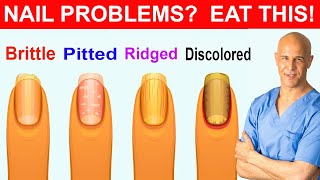 NAIL PROBLEMS  EAT THIS  Dr Mandell [upl. by Myriam]