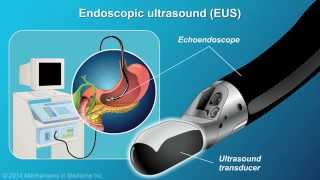 Understanding EUSFNA [upl. by Shari]