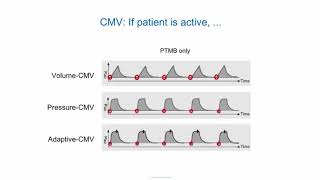 eLearning Ventilation modes ABC [upl. by Tsai]