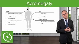 Acromegaly – Endocrinology  Lecturio [upl. by Eldreda29]