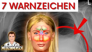 AUTOIMMUNERKRANKUNG Immunattacken erkennen RheumaArzt erklärt Warnzeichen [upl. by Teena]