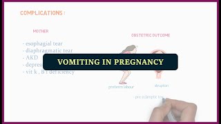 Vomiting in pregnancy  medicos [upl. by Eram]