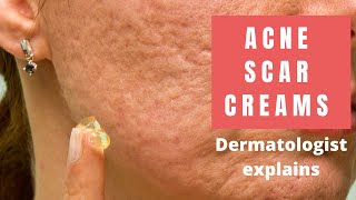 Acne Scar Creams  Dermatologist Reviews [upl. by Nehgam]