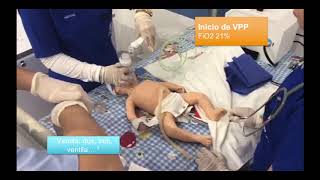 REANIMACION NEONATAL ALGORITMO COMPLETO [upl. by Amalle]