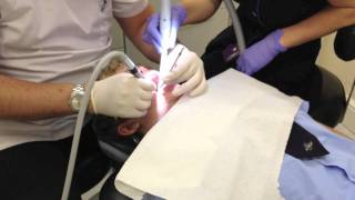 dentist injection drill and filling [upl. by Aneen930]