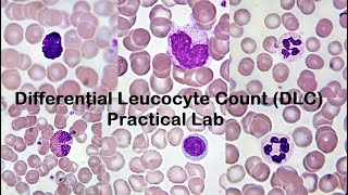 Differential Leucocyte Count DLC Practical Lab [upl. by Glanti]