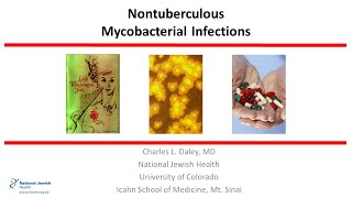 Nontuberculous Mycobacterial Infections 2019 [upl. by O'Reilly]