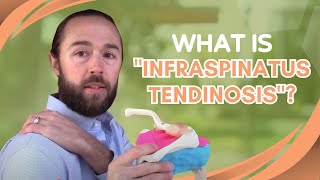 What is quotInfraspinatus Tendinosisquot shoulder pain [upl. by Fahland]