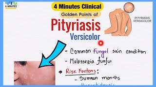 Skin fungal infection Tinea versicolor symptoms causes Treatment [upl. by Dumas676]