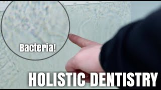 What is Holistic Dentistry [upl. by Theodora8]