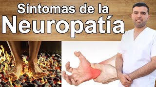 Sintomas de la Neuropatía [upl. by Thorn927]