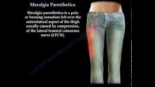 Meralgia Paresthetica  Everything You Need To Know  Dr Nabil Ebraheim [upl. by Caplan]