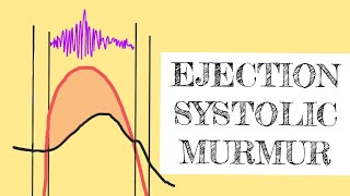 Ejection systolic murmur [upl. by Ayatnohs]