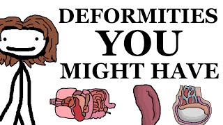 Deformities That You Might Have [upl. by Niwled]