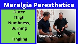 Meralgia Paresthetica Outer thigh numbness burning and tingling [upl. by Onez]