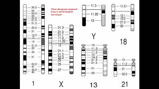 Cytogenetics II Chromosome Analysis amp Karyotypes [upl. by Kylila690]