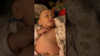 Example of Retractions Belly Breathing and Tachypnea in Infant [upl. by Seraphina198]