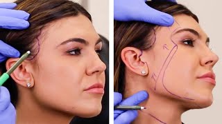 7 Ways You Can Get a Facelift Without Surgery  Dr Anthony Youn [upl. by Reede316]