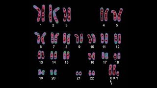 Human Genetics  Karyotyping [upl. by Nivrae20]