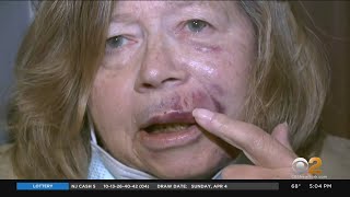 Woman Speaks Out After Random Sucker Punch Attack [upl. by Neit]