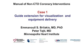 Case 1 PCI Manual  Guide extension for visualization and equipment delivery [upl. by Mellitz505]