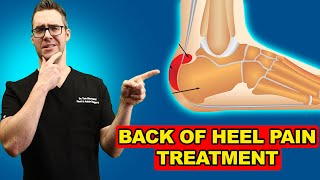 Heel Bursitis  Causes and Treatment [upl. by Flannery]