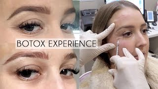 Everything To Know About Botox For Face TMJ Hyperhidrosis  Beauty Transformations [upl. by Haveman]