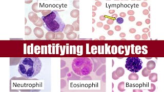 Identifying Leukocytes [upl. by Geraldine326]