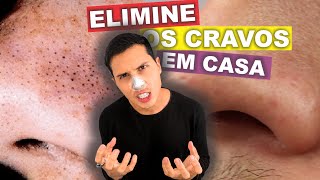 COMO REMOVER CRAVOS DO NARIZ EM 6 MINUTOS EM CASA [upl. by Onateag977]