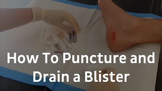 How To Puncture And Drain A Blister  Blister Treatment [upl. by Eidahs]