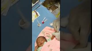 Symptoms of Jaundice  Dr Akash Chaudhary  CARE Hospitals Banjara Hills [upl. by Egief]