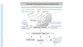 Post Operative Nausea and Vomiting PONV  Anaesthesia [upl. by Eadas]