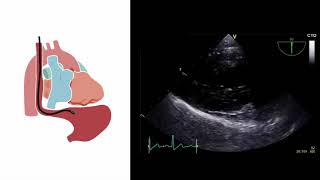 Basics of Transthoracic Echocardiography Dr Viola William [upl. by Heisser]