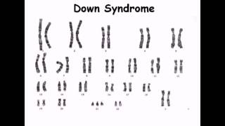 8 Karyotype [upl. by Akemehc]