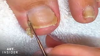 How Toenails Are Professionally Cleaned [upl. by Tye]