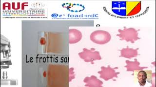 MORPHOLOGIE EN HEMATOLOGIE EPISODE 2 [upl. by Lilla248]