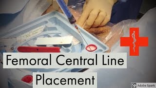 Femoral Central Line Placement [upl. by Vick197]