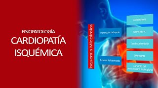 Fisiopatología  Isquemia miocardica [upl. by Ellissa]