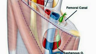 Femoral TriangleSheathCanalHernia [upl. by Schroeder266]