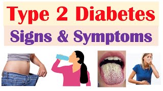 Type 2 Diabetes Signs amp Symptoms amp Why They Occur amp Associated Conditions [upl. by Alamak]