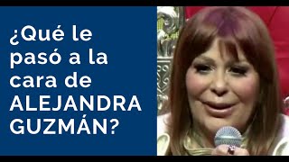 Rostro de ALEJANDRA GUZMÁN ¿Qué le pasó [upl. by Suchta]