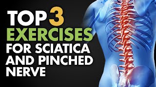 Top 3 Exercises for Sciatica and Pinched Nerve [upl. by Conard]